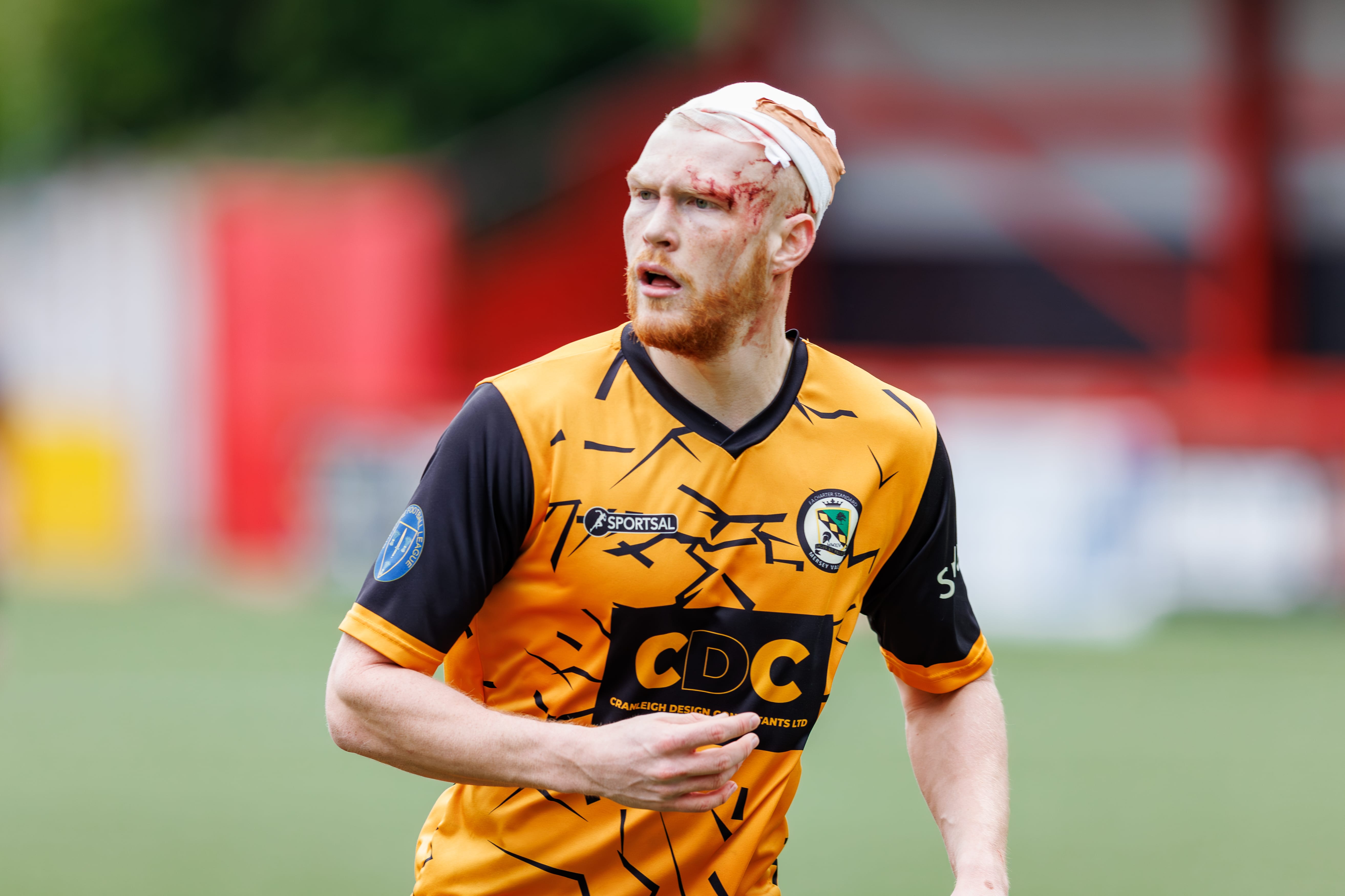 42 Aftermath of clashing heads with Michael O